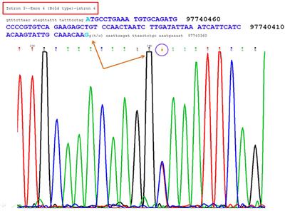 A Novel DPYD Variant Associated With Severe Toxicity of Fluoropyrimidines: Role of Pre-emptive DPYD Genotype Screening